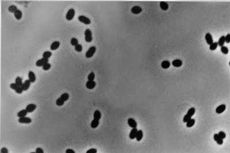 Bakteri Nitrosomonas: Bakteri Pengoksidasi Amonia