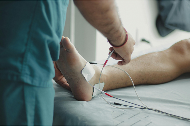 6 Tanda Stroke yang Bisa Dilihat di Kaki, Apa Saja?