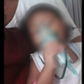 Musim Pancaroba dan Gaya Hidup Tak Sehat Memicu ISPA, Ini Kata Dokter