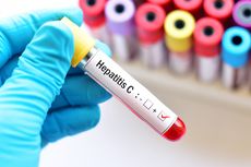 Pasien Cuci Darah Rentan Tertular Hepatitis C