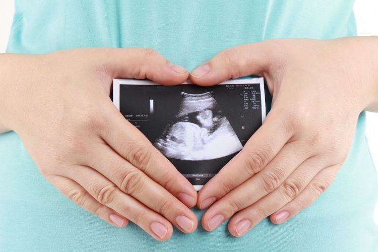 Ilustrasi kehamilan yang bisa menjadi faktor risiko penyebab tumor desmoid.