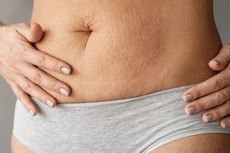 7 Cara Alami Hilangkan Stretch Mark, Pakai Minyak Bulus?