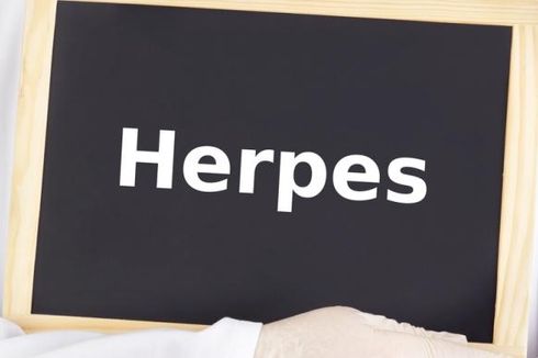 Penyebab Herpes Kulit dan Cara Mengobatinya