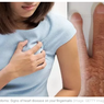 Tampilan Kuku di Jari Tangan Bisa Jadi Tanda Risiko Serangan Jantung
