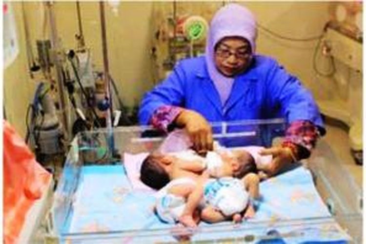 Bayi kembar siam Aldi Wahyu Pratam dan Aldo Wahyu Pratama anak pasangan suami istri, Sukoto (28) dan Puji Astutik (26) warga Dusun Srikaton, Desa Banjarejo, Kecamatan Pudak, Kabupaten Ponorogo akhirnya dijemput tim medis RSU dr Soetomo Surabaya untuk dirujuk dan dioperasi, Selasa (17/6/2014).