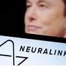 Saat Elon Musk Umumkan Prestasi Tanam Chip di Otak Manusia