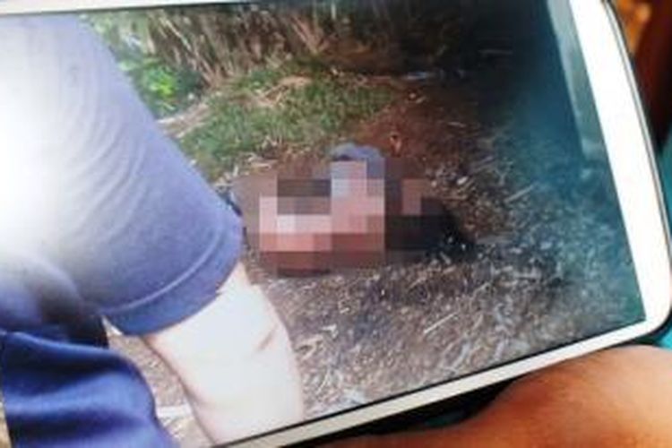 Foto kondisi Tari Handayani (21), warga Kampung Cilubang, Bubulak, Kecamatan Bogor Barat, Kota Bogor, saat dirinya terbakar disebuah rumah kosong, di Kampung Cikiray, RT 01/06, Desa Sukaraja, Kecamatan Sukaraja, Kabupaten Bogor, Rabu (10/9/2014). 