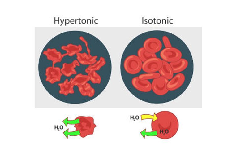 Perbedaan sel darah merah dalam larutan hipertonik (mengalami krenasi) dan dalam larutan isotonik (keadaan normal).