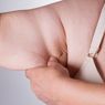 Kenali Apa Itu Selulit dan Bedanya dengan Stretch Marks