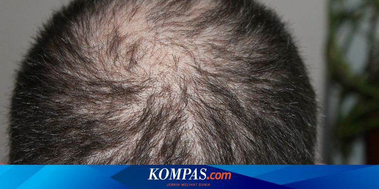 8 Bad Habits That Make Your Hair Thin Fast Men Must Know Netral News