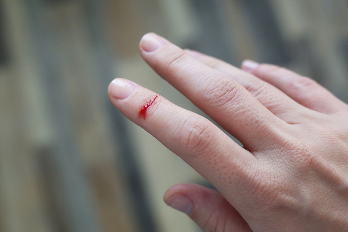 Ilustrasi luka tersayat kertas atau paper cut. Luka sayatan kertas yang mengenai jari terasa lebih menyakitkan.
