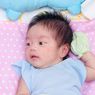 Cara Menangani Kulit Bayi yang Memerah dan Beruntusan