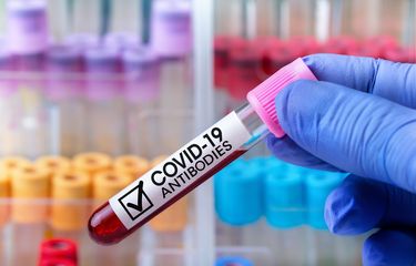 Ilustrasi tes antibodi terhadap SARS-CoV-2. Ilmuwan temukan antibodi Covid-19 masih ada di tubuh penyintas hingga 10 bulan setelah terinfeksi.