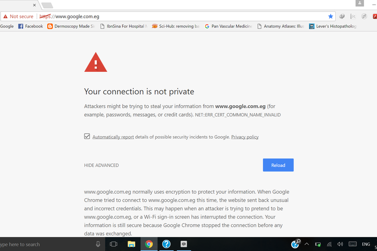 cara mengatasi your connection is not private 
