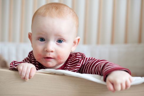 Bayi Idap Eczema karena Banyak Disentuh, Sang Ayah Sayangkan Respons Netizen