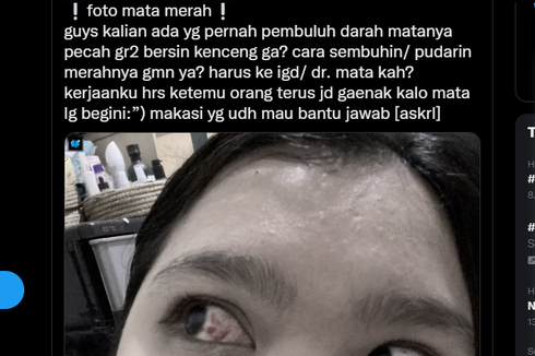 Ramai Pembuluh Darah Mata Pecah akibat Bersin Kencang, Ini Kata Dokter