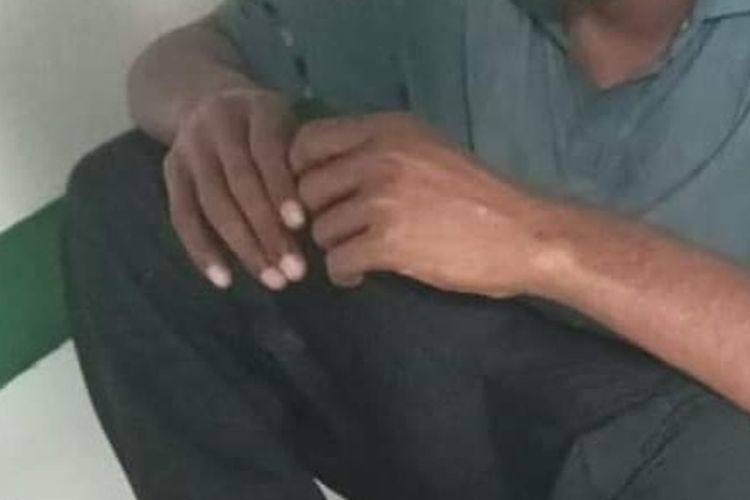Dinkes Lhokseumawe Catat 575 Warga Gangguan Jiwa, Tiga Masih Dipasung