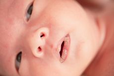 6 Penyebab Bibir Kering Pada Bayi