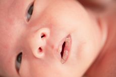 5 Cara Mengatasi Bibir Kering pada Bayi