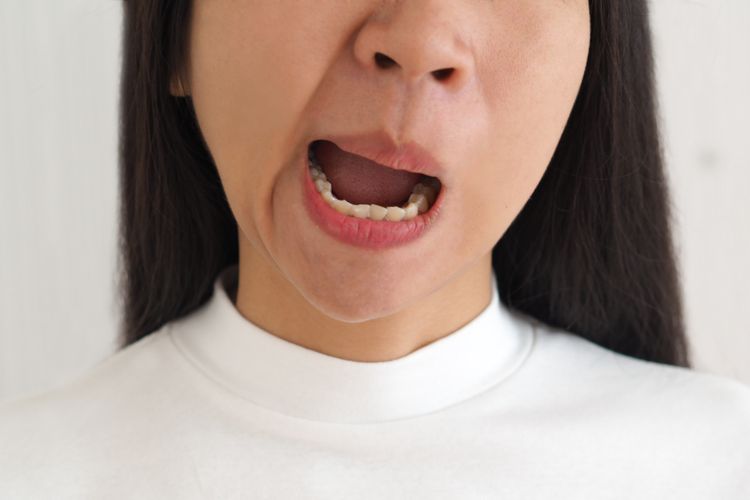 Ilustrasi bells palsy