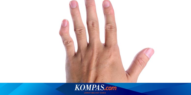 Penyakit Mallet Finger Gejala Penyebab Pengobatan Kompas Com