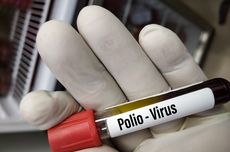 98.633 Anak di Buleleng Jadi Target Sasaran Vaksinasi Polio