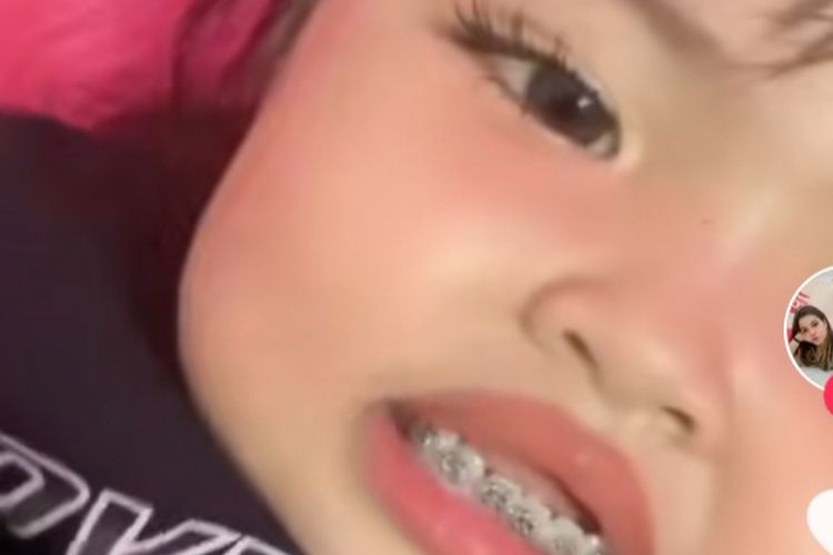 Tangkapan layar video TikTok anak kecil dengan gigi dipasang behel
