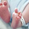 Hipotiroid Kongenital pada Bayi: Gejala dan Penyebabnya