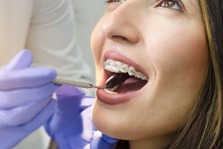 Mengetahui kenapa gigi kuning setelah dibehel sangatlah penting untuk mencegahnya berubah warna.