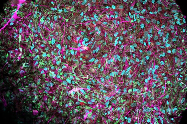 Ilustrasi sel otak atau brain organoids.