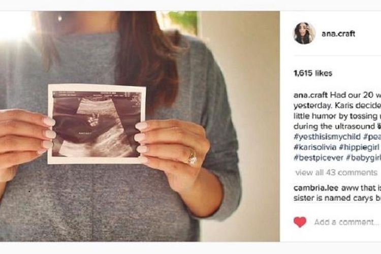 Ana Craft mengunggah foto USG yang memperlihatkan janin dalam kandungannya sedang mengacungkan dua jari salam damai.