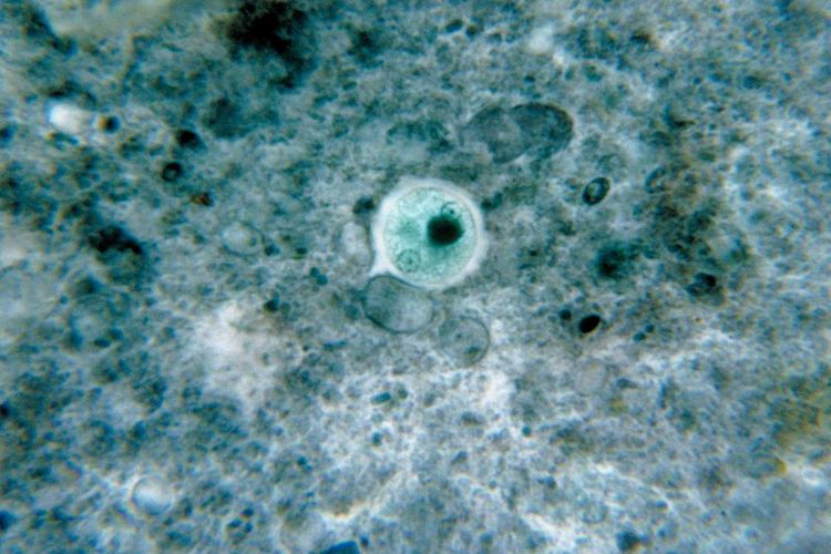 Entamoeba histolytica, protista mirip hewan yang menyebabkan amebiasis atau infeksi pada usus.