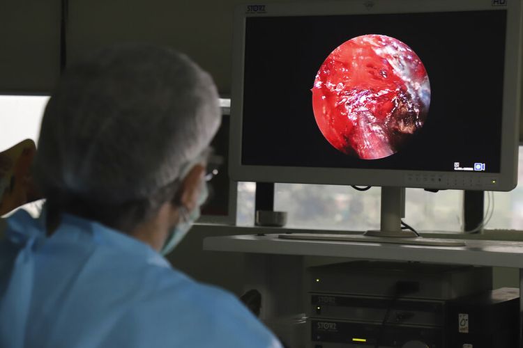 Dokter India BP Tyagi melakukan operasi lanjutan sinus endoskopik fungsional pada seseorang yang menderita mucormycosis di sebuah rumah sakit di Ghaziabad, pinggiran New Delhi, India, Minggu, 23 Mei 2021. 