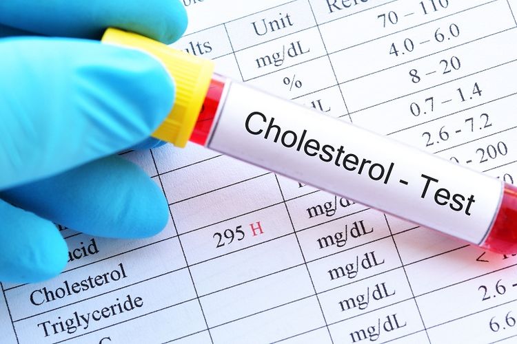 Konsumsi makanan tinggi lemam saat lebaran dapat berkontribusi terhadap peningkatan kolesterol.