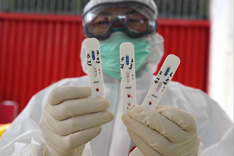 Petugas medis Dinas Kesehatan Kota Bogor menunjukkan hasil uji cepat (rapid test) massal Covid-19 di Pasar Bogor, Kota Bogor, Rabu (29/4/2020).  Rapid test untuk mencegah penyebaran wabah Covid-19.