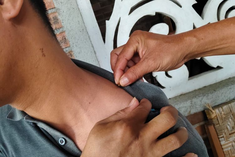 Dulu Dipakai Hippocrates, Terapi Sengat Lebah Kini Bisa Dicoba di Ashfa Madu Borobudur