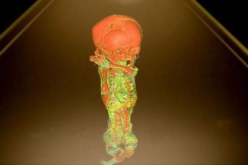 Di Museum Jerman, Hologram Ungkap Misteri Di Balik Mumi