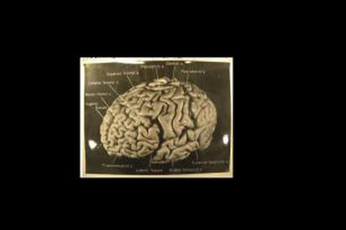 Penelitian mengungkap bahwa otak Einstein memiliki beberapa perbedaan karakteristik dibanding otak manusia umumnya. Diduga, perbedaan itu berkontribusi pada kecerdasan Einstein. 