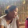 Cerita Pilu Bayi di Ponorogo, Lahir Tanpa Tempurung Kepala