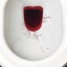 9 Penyebab Urine Berdarah pada Pria