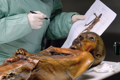 Bagaimana Ötzi Si Manusia Es Meninggal?
