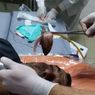 Ikan yang Dipancingnya Tersangkut ke Tenggorokan, Pria Ini Hampir Mati
