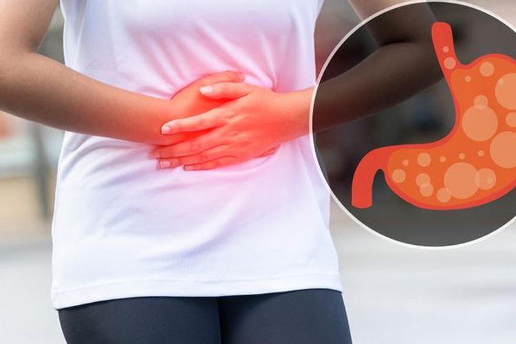 Mudik Nyaman Tanpa Gangguan Asam Lambung, Ini Tips Pencegahan dan Penanganannya