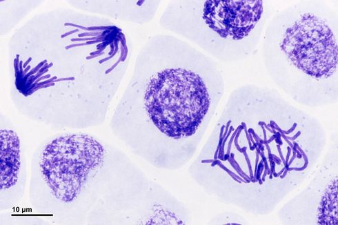 Tahap-Tahap Mitosis Sel