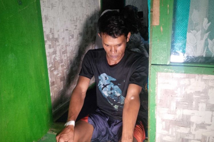 Salah seorang warga yang iduga mengalami keracunan makanan memperlihatkan bekas infus di rumahnya di Kampung Kebonkawung, Desa Citamiang, KecamatanKadudampit, Sukabumi, jawa barat, Selasa (24/7/2018). 
