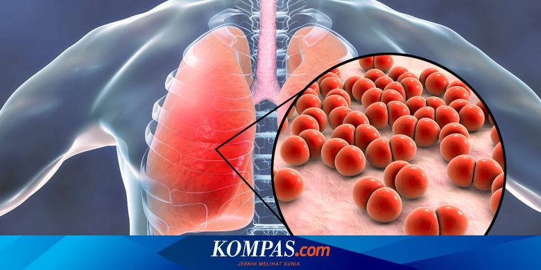 Apa Itu Pneumonia Jenis Penyakit Pernapasan Yang Ramai Saat Ini
