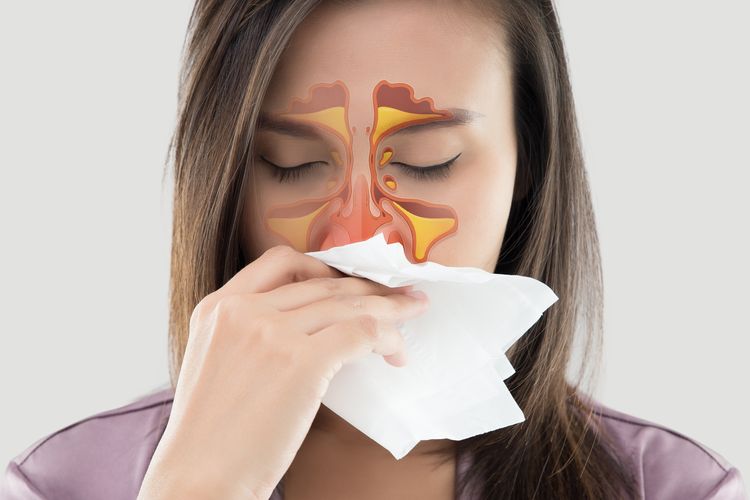 Ilustrasi infeksi sinus. Infeksi sinus yang berulang 2 kali atau lebih dalam 1 tahun dapat menjadi tanda-tanda imunodefisiensi primer yang harus Anda waspadai. 
