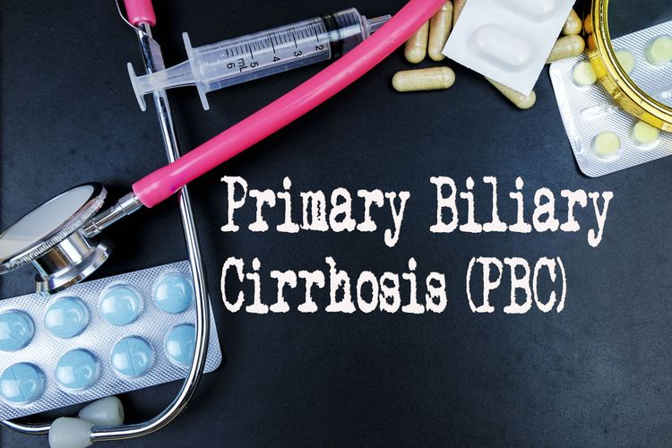 Ilustrasi Primary Biliary Cirrhosis