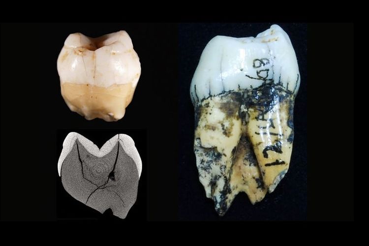 Manusia Pertama Penghuni Indonesia Diungkap Gigi Ini Jejaknya Halaman All Kompas Com