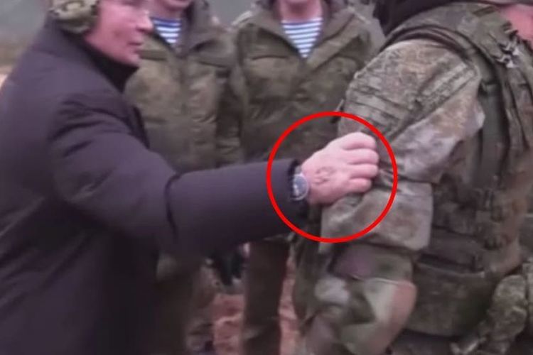 Bekas infus di tangan Presiden Rusia Vladimir Putin.